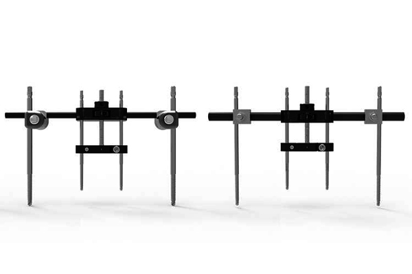 熱塑PEEK碳纖維骨外固定架